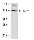 AP-2β (H-87): sc-8976. Western blot analysis of AP-2β expression in KNRK nuclear extract.