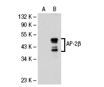 AP-2β (H-87): sc-8976. Western blot analysis of AP-2β expression in non-transfected: sc-117752 (A) and human AP-2β transfected: sc-113759 (B) 293T whole cell lysates.