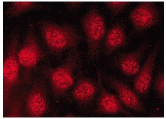 AP-2β (H-87): sc-8976. Immunofluorescence staining of methanol-fixed HeLa cells showing nuclear localization.