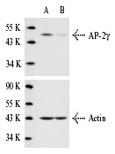 AP-2γ siRNA (h): sc-29696. Western blot analysis of AP-2γ expression in non-transfected control (A) and AP-2γ siRNA transfected (B) HeLa cells. Blot probed with AP-2γ (6E4/4): sc-12762. Actin (I-19): sc-1616 used as specificity and loading control.