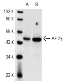 AP-2γ (6E4/4): sc-12762. Western blot analysis of AP-2γ expression in ZR-75-1 (A) and MDA-MB-468 (B) whole cell lysates.