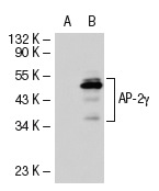 AP-2γ (6E4/4): sc-12762. Western blot analysis of AP-2γ expression in non-transfected: sc-117752 (A) and human AP-2γ transfected: sc-116386 (B) 293T whole cell lysates.