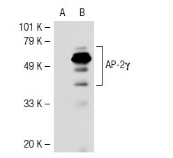 AP-2γ (AP2g 6E4/4): sc-53162. Western blot analysis of AP-2γ expression in non-transfected: sc-117752 (A) and human AP-2γ transfected: sc-116386 (B) 293T whole cell lysates.