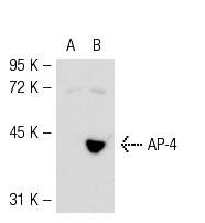 AP-4 (N-17): sc-18593. Western blot analysis of AP-4 expression in non-transfected: sc-117752 (A) and mouse AP-4 transfected: sc-118454 (B) 293T whole cell lysates.