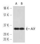 ALY (11G5): sc-32311. Western blot analysis of ALY expression in Jurkat (A) and HeLa (B) nuclear extracts.