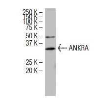 ANKRA (A26): sc-101005. Western blot analysis of ANKRA expression in IMR-32 whole cell lysate.