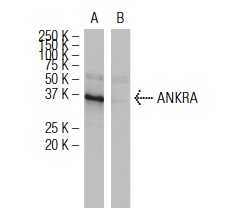 ANKRA (A26): sc-101005 Western blot analysis of ANKRA expression in human ANKRA transfected (A) and non-transfected (B) 293T whole cell lysates.