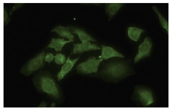 ANKRA (A26): sc-101005. Immunofluorescence staining of paraformaldehyde-fixed HeLa cells showing membrane and cytoplasmic localization.