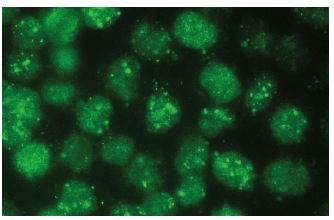ATRX (D-5): sc-55584. Immunofluorescence staining of methanol-fixed HeLa cells showing nuclear localization.