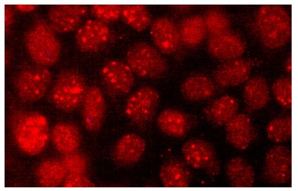 ATRX (D-5): sc-55584. Immunofluorescence staining of methanol-fixed HeLa cells showing nuclear localization.