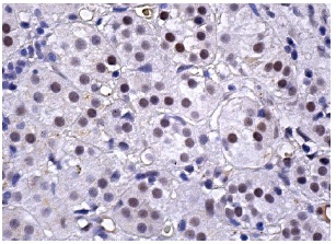 ATRX (D-5): sc-55584. Immunoperoxidase staining of formalin fixed, paraffin-embedded human adrenal gland tissue showing nuclear staining of glandular cells.