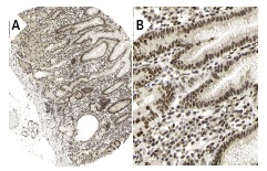 ATRX (H-300): sc-15408. Immunoperoxidase staining of formalin fixed, paraffin-embedded human stomach tissue showing nuclear staining of glandular cells at low (A) and high (B) magnification. Kindly provided by The Swedish Human Protein Atlas (HPA) program.