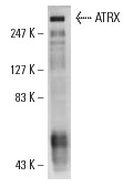 ATRX (H-300): sc-15408. Western blot analysis of ATRX expression in HeLa nuclear extract.
