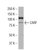 CARF (14.4): sc-101206. Western blot analysis of CARF expression in HeLa nuclear extract.