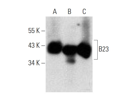 B23 (E-3): sc-271737. Western blot analysis of B23 expression in 293T (A), HeLa (B) and HEL 92.1.7 (C) whole cell lysates.
