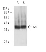 B23 (FC-8791): sc-32256. Western blot analysis of B23 expression in HEL 92.1.7 (A) and HeLa (B) whole cell lysates.