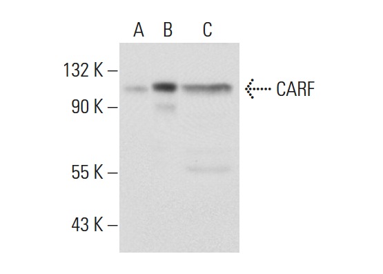 CARF (14.4): sc-101206. Western blot analysis of CARF expression in non-transfected 293T: sc-117752 (A), human CARF transfected 293T: sc-170745 (B) and AML-193 (C) whole cell lysates.