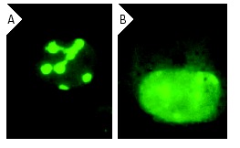 B23 (FC-8791): sc-32256. Immunofluorescence staining of NPM/B23 in Jurkat cells. Normally the majority of NPM/B23 is in the nucleoli (A). However, dissociation of NPM/B23 from nucleoli to nucleoplasm and cytoplasm is observed after treatment with camptothecin (B). Kindly provided by Dr. P.K. Chan at Baylor University, Texas.