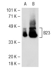 B23 (FC-8791): sc-32256. Western blot analysis of B23 expression in 293T (A) and HeLa (B) whole cell lysates.