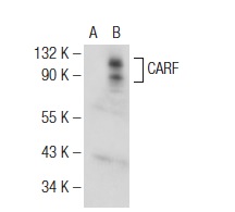 CARF (14.4): sc-101206. Western blot analysis of CARF expression in non-transfected: sc-117752 (A) and human CARF transfected: sc-159702 (B) 293T whole cell lysates.