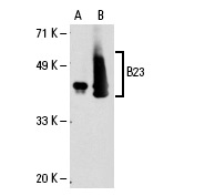 B23 (NA24): sc-53175. Western blot analysis of B23 expression in non-transfected: sc-110760 (A) and human B23 transfected: sc-111207 (B) 293 whole cell lysates.