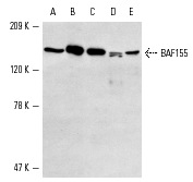 BAF155 (C-19): sc-9747. Western blot analysis of BAF155 expression in HeLa (A), Jurkat (B), K-562 (C), KNRK (D) and NIH/3T3 (E) nuclear extracts.