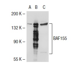 BAF155 (DXD7): sc-32763. Western blot analysis of BAF155 expression in non-transfected 293T: sc-117752 (A), human BAF155 transfected 293T: sc-111379 (B) and K-562 (C) whole cell lysates.
