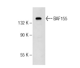 BAF155 (DXD7): sc-32763. Western blot analysis of BAF155 expression in Jurkat whole cell lysate.