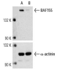 BAF155 siRNA (h): sc-29780. Western blot analysis of BAF155 expression in non-transfected control (A) and BAF155 siRNA transfected (B) HeLa cells. Blot probed with BAF155 (R-18): sc-9746. α-actinin (H-2): sc-17829 used as specificity and loading control.
