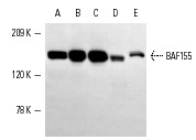 BAF155 (R-18): sc-9746. Western blot analysis of BAF155 expression in HeLa (A), Jurkat (B), K-562 (C), KNRK (D) and NIH/3T3 (E) nuclear extracts.