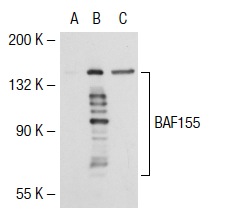 BAF155 (R-18): sc-9746. Western blot analysis of BAF155 expression in non-transfected 293T: sc-117752 (A), human BAF155 transfected 293T: sc-111379 (B) and K-562 (C) whole cell lysates.
