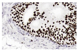 BAF170 (E-6): sc-17838. Immunoperoxidase staining of formalin fixed, paraffin-embedded human epididymis tissue showing nuclear staining of glandular cells. Kindly provided by The Swedish Human Protein Atlas (HPA) program.