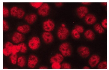 BAF170 (E-6): sc-17838. Immunofluorescence staining of methanol-fixed HeLa cells showing nuclear localization.