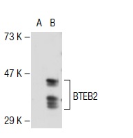 BTEB2 (H-300): sc-22797. Western blot analysis of BTEB2 expression in non-transfected: sc-117752 (A) and mouse BTEB2 transfected: sc-118866 (B) 293T whole cell lysates.