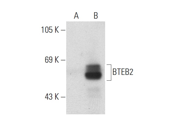 BTEB2 (H-300): sc-22797. Western blot analysis of BTEB2 expression in non-transfected: sc-117752 (A) and human BTEB2 transfected: sc-172356 (B) 293T whole cell lysates.