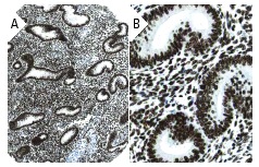 C23 (D-6): sc-17826. Immunoperoxidase staining of formalin fixed, paraffin-embedded human endometrium tissue showing nuclear staining of glandular cells and cells in endometrial stroma and myometrum at low (A) and high (B) magnification. Kindly provided by The Swedish Human Protein Atlas (HPA) program.
