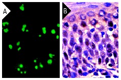 C23 (D-6): sc-17826. Immunofluorescence staining of methanol-fixed HeLa cells (A) and Immunoperoxidase staining of formalin fixed, paraffin-embedded human tonsil tissue (B) showing nucleolar localization.