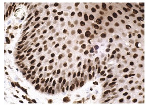 C23 (H-250): sc-13057. Immunoperoxidase staining of formalin fixed, paraffin-embedded human cervix tissue showing nucleolar and nuclear staining of squamous epithelial cells.