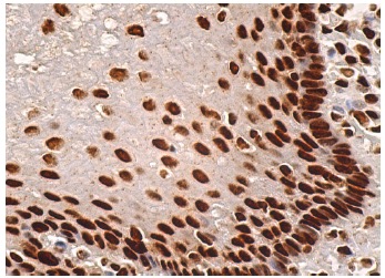 C23 (MS-3): sc-8031. Immunoperoxidase staining of formalin fixed, paraffin-embedded human esophagus tissue showing nuclear staining of squamous epithelial cells.