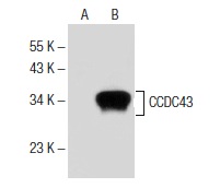CCDC43 (K-13): sc-137379. Western blot analysis of CCDC43 expression in non-transfected: sc-117752 (A) and human CCDC43 transfected: sc-371766 (B) 293T whole cell lysates.