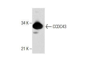 CCDC43 (K-13): sc-137379. Western blot analysis of CCDC43 expression in human skeletal muscle tissue extract.