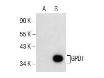 GPD1 (E-7): sc-376219. Western blot analysis of GPD1 expression in non-transfected: sc-117752 (A) and human GPD1 transfected: sc-114223 (B) 293T whole cell lysates.