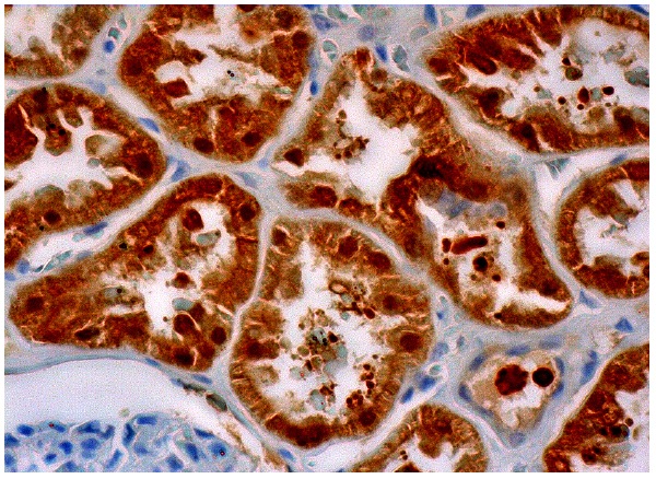 GPD1 (E-7): sc-376219. Immunoperoxidase staining of formalin fixed, paraffin-embedded human kidney tissue showing cytoplasmic and nuclear staining of cells in tubules.