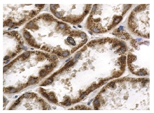 SDF-1 (FL-93): sc-28876. Immunoperoxidase staining of formalin fixed, paraffin-embedded human kidney tissue showing cytoplasmic staining of cells in tubules.