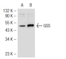 GSS (H-300): sc-28966. Western blot analysis of GSS expression in non-transfected: sc-117752 (A) and human GSS transfected: sc-170509 (B) 293T whole cell lysates.