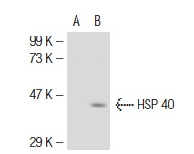 HSP 40 (C-20): sc-1800. Western blot analysis of HSP 40 expression in non-transfected: sc-117752 (A) and mouse HSP 40 transfected: sc-120911 (B) 293T whole cell lysates.