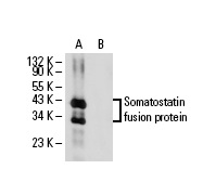 Western blot analysis of human recombinant Somatostatin fusion protein (A). Blots were probed with Somatostatin (H-11): sc-74556 (A) and Somatostatin (H-11): sc-74556 preincubated with cognate peptide (B).