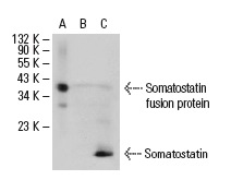 Somatostatin (H-11): sc-74556. Western blot analysis of human recombinant Somatostatin fusion protein (A) and expression in non-transfected: sc-117750 (B) and human Somatostatin transfected: sc-110012 (C) CHO whole cell lysates.