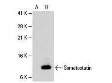 Somatostatin (D-20): sc-7819. Western blot analysis of Somatostatin expression in non-transfected (A) and human Somatostatin transfected (B) CHO whole cell lysates.