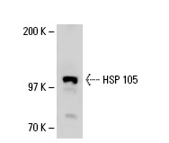 HSP 105 (B-7): sc-74550. Western blot analysis of HSP 105 expression in KNRK whole cell lysate.